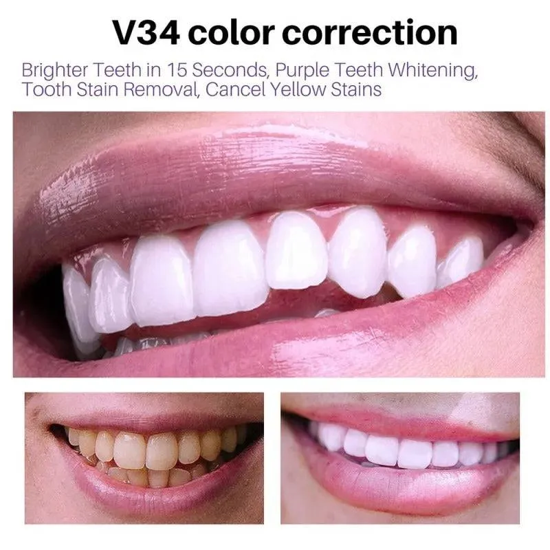 Toothpaste Mousse V34 - Your Solution to Teeth Cleaning, Whitening, and Stain Removal