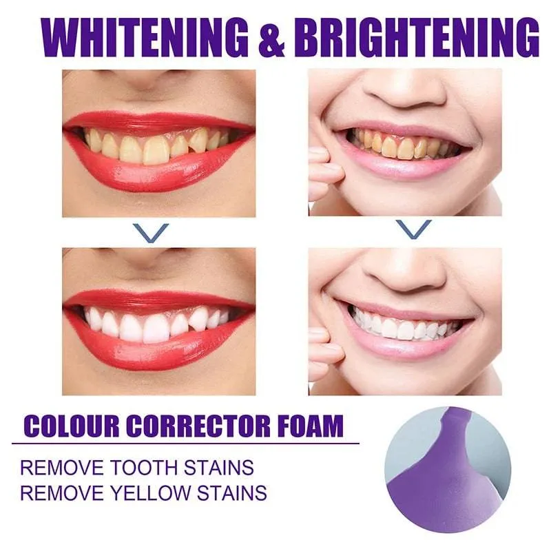 Toothpaste Mousse V34 - Your Solution to Teeth Cleaning, Whitening, and Stain Removal