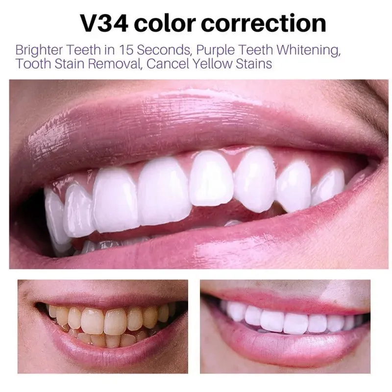 Toothpaste Mousse V34 - Your Solution to Teeth Cleaning, Whitening, and Stain Removal