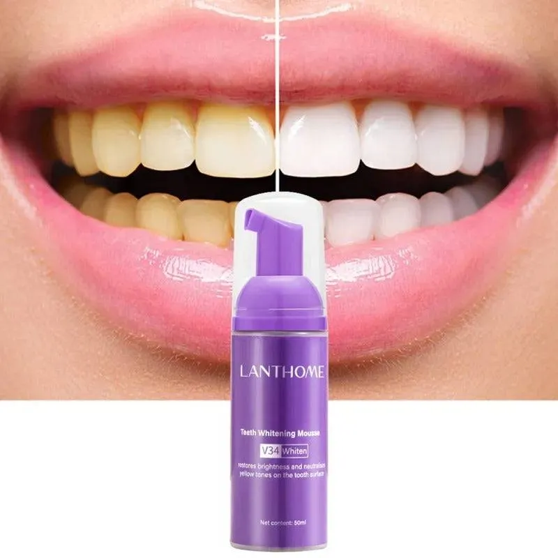 Toothpaste Mousse V34 - Your Solution to Teeth Cleaning, Whitening, and Stain Removal